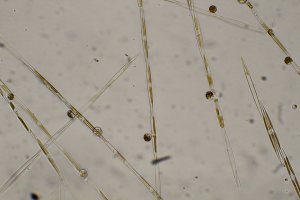Pseudo-nitzchia, the marine diatom that produces the toxin domoic acid. Credit: NOAA Fisheries/NWFSC